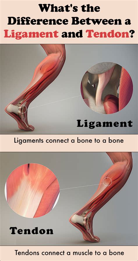 What are names of the two junction ends… Tendon vs Ligament: What's the Difference? - Medical Wave