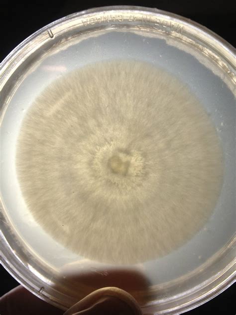 Mycelium On Agar Picture Thread Advanced Mycology Shroomery Message