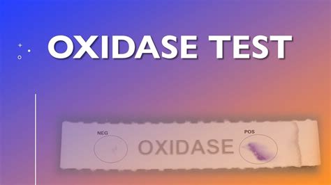Oxidase Test Youtube