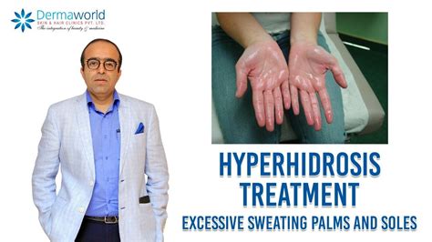 Hyperhidrosis Treatment Excessive Sweating Palms And Soles In Hindi