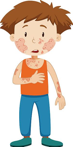 Skin Condition Clip Art Vector Images And Illustrations Istock