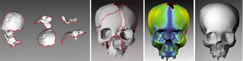 Computational Forensics Digital Skull Restoration And Facial