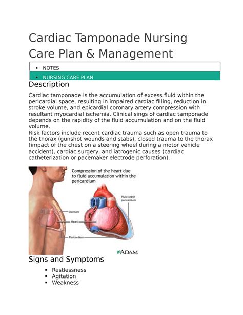 Cardiac Tamponade Nursing Care And Management Plan Procedure And