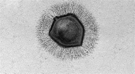 Understanding The Mysteries Of Giant Viruses Advanced Science News