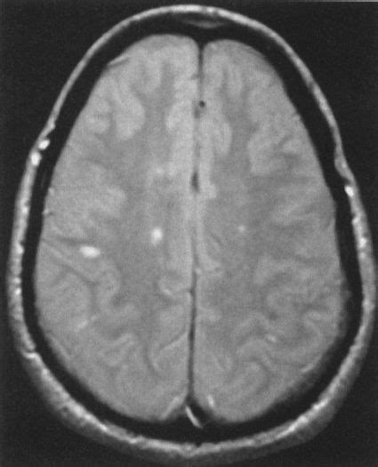 Brain Radiology Key