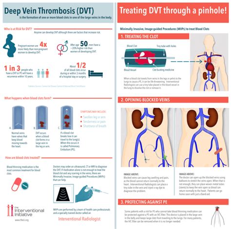 Treatment For Deep Vein Thrombosis In Denver Co Mips Vein Center