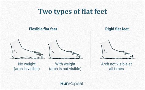Arch Support For Runners What How And Why In Depth Guide