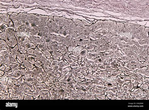 Reticular Fibres In Human Pituitary Gland Light Micrograph Stock Photo