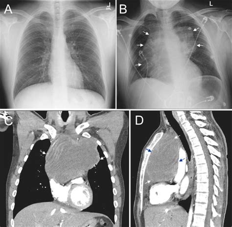 Southwest Journal Of Pulmonary Critical Care And Sleep Imaging