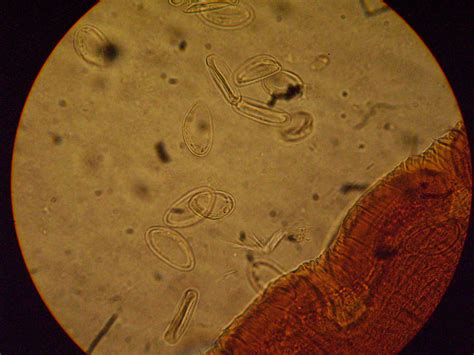 Enterobius Vermicularis Neden Olur Parazit Decaris Pret Enterobius My