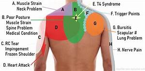 Shoulder Diagram Diagnosis Chart Shoulder Exp