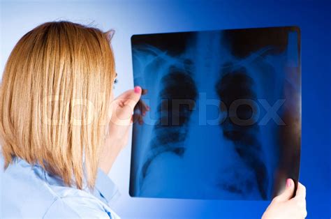 Female Doctor Carefully X Ray Of Patient Stock Image Colourbox