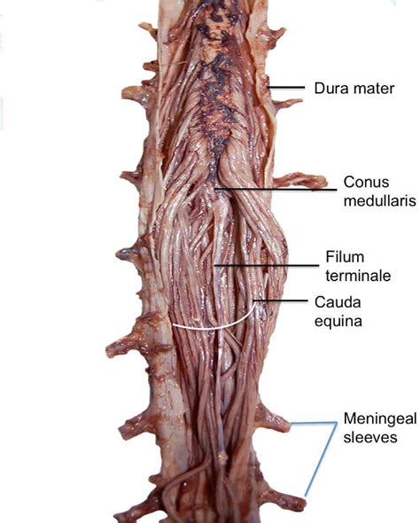 Section 1, Chapter 3: Anatomy of the Lumbar Nerves : Wheeless' Textbook