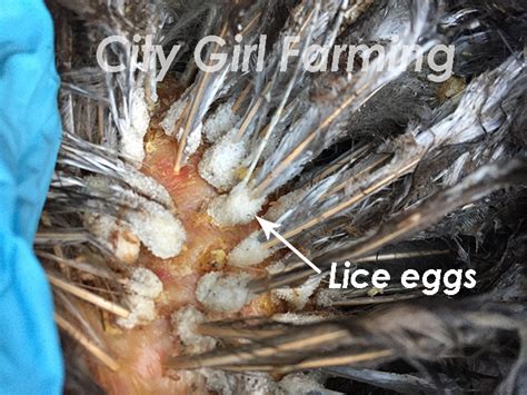 Lice Eggs City Girl Farming