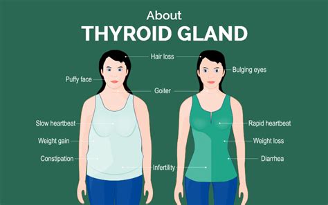 Basics Of Thyroid Disease Types Causes Symptoms Test Treatment And Cost