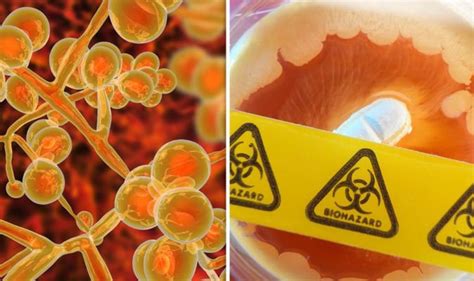 Deadly Fungal Infection Is Spreading Rapidly Across The World And It