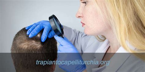 Alopecia Cause E Tipologie Areata Da Trazione Cicatriziale