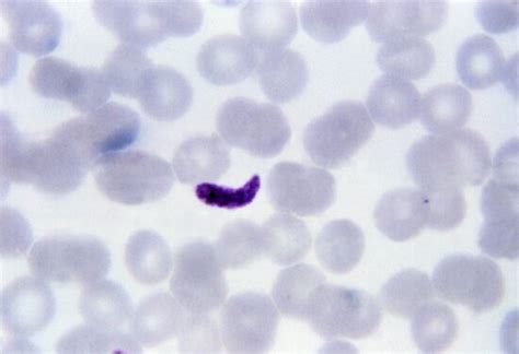 Free Picture Thick Film Micrograph Plasmodium Falciparum Gametocyte Cntr Ring Form