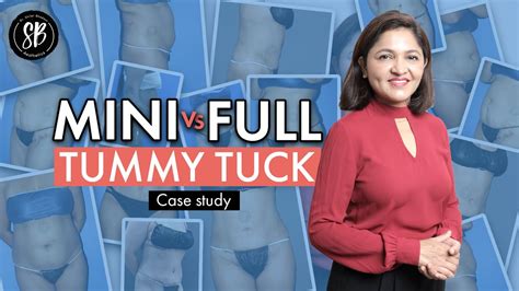 Mini Vs Full Tummy Tuck Surgery Remove Excess Skin And Fat From The Abdomen Dr Shilpi