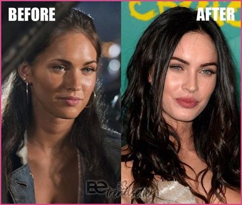 Has megan fox had plastic surgery? Megan Fox Plastic Surgery Before And After REVEALED! 2019 ...