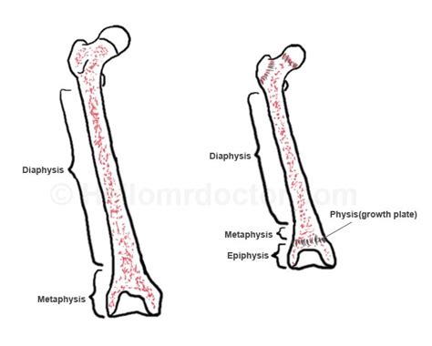 Metaphysis Anatomy Pictures Clinical Significance And Pathology