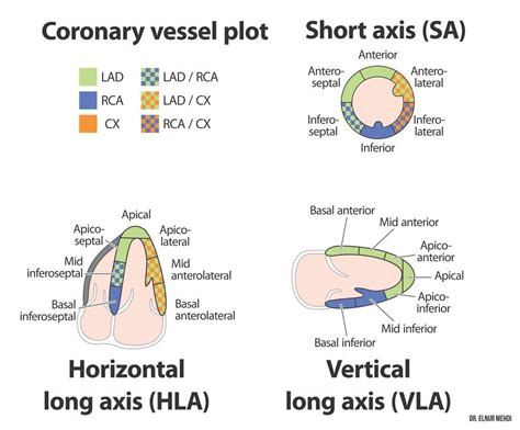 Cardiology Arteries Vessel Health Case Axis Supply Notes Result