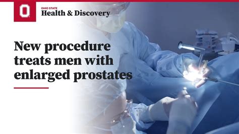 New Procedure Treats Men With Enlarged Prostates Ohio State Medical