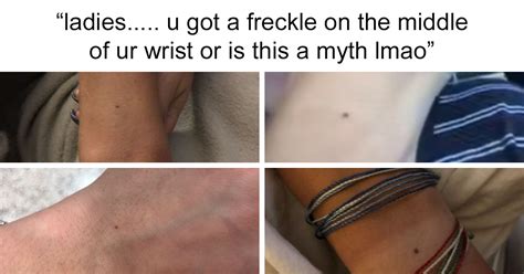 What Is The Meaning Of A Freckle On The Wrist And Should You Be Concerned Justinboey