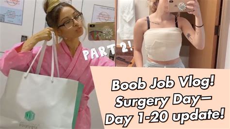 Breast Augmentation Surgery Day Post Op Part 2 Youtube