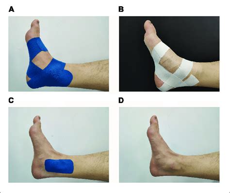 Four Different Ankle Taping Treatments A Kt Kinesiology Taping