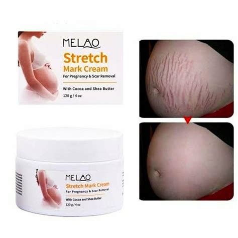 Melao Stretch Mark Cream For Pregnancy And Scar Removal 120g Saparif