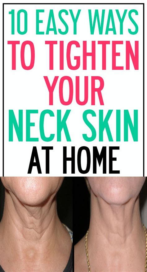 10 Easy Ways To Tighten Your Neck Skin Loose Neck Skin Skin Healthy