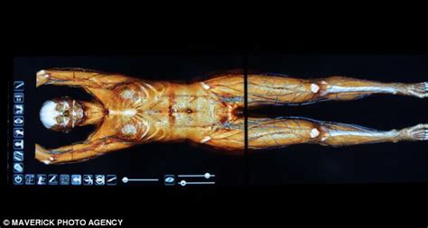 Human Cadaver Anatomy