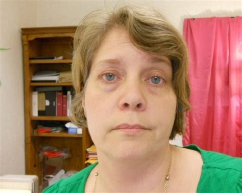 Never ice the affected eye for more than 20 minutes at a time. How to Get Rid of Black Spots under Eyes - Home Remedy for ...