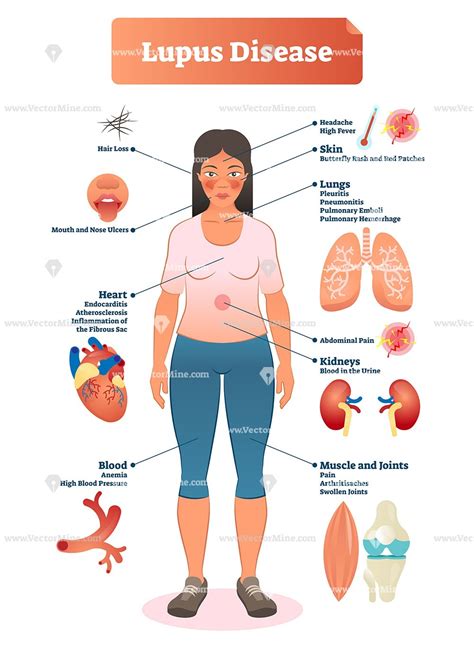 Pin On Health And Medicine Illustrated