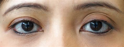 Maybe you would like to learn more about one of these? Anyone here has triple eyelids? - Random - OneHallyu