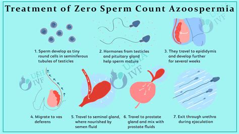 Treatment Of Zero Sperm Count Azoospermia No Sperm Count Success