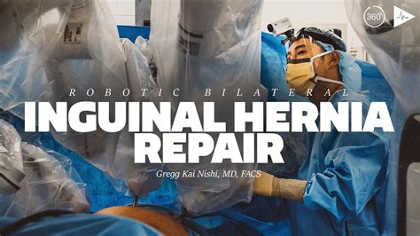 Robotic Bilateral Inguinal Hernia Repair By Dr Gregg Kai Nishi Case