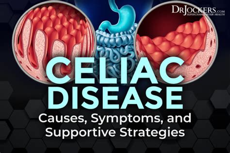 Celiac Disease Symptoms Causes And Natural Support Strategies
