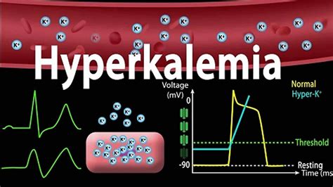 Hyperkalemia Causes Signs Symptoms Ecg Changes And Treatment