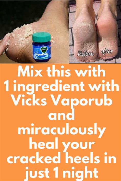 Mix This With 1 Ingredient With Vicks Vaporub And Miraculously Heal