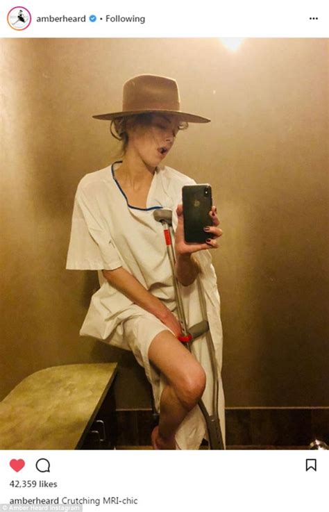 Amber Heard Poses With Crutches After Sustaining A Broken Bone