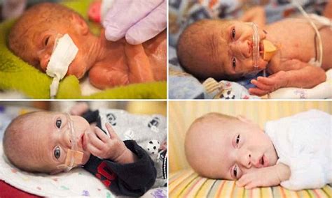 Baby Born At Just 26 Weeks Weighing 1lb Finally Comes Home Daily Mail