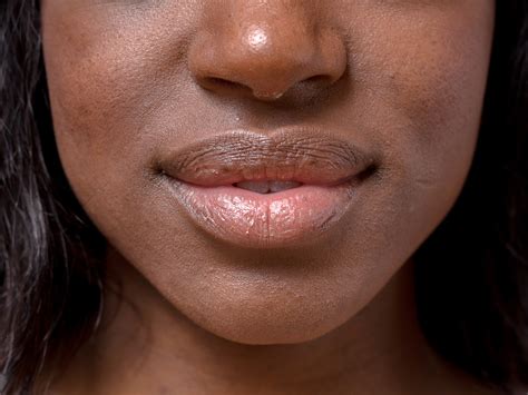 What Causes Lips To Turn Black Naturally