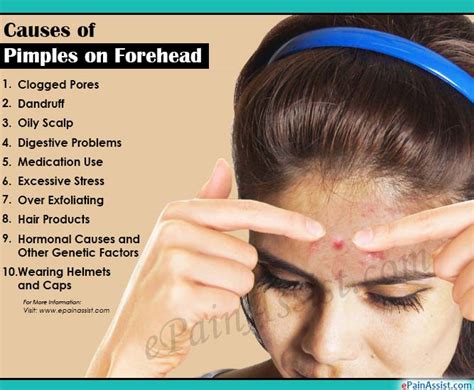 What Causes Pimples On Forehead And Ways To Get Rid Of It