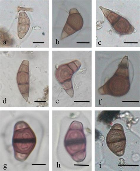 Photomicrographs Of Airborne Curvularia Spores Types Ac Lunata Df