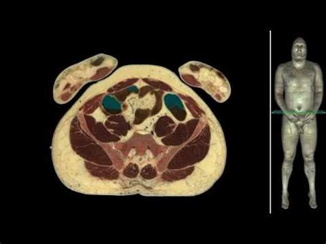 This photo gallery presents the anatomy of the abdomen by means of ct (axial. Female Anatomy Abdomen Images | carfare.me 2019-2020
