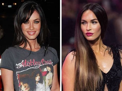 Celebrity Before And After Plastic Surgeries Celebrities