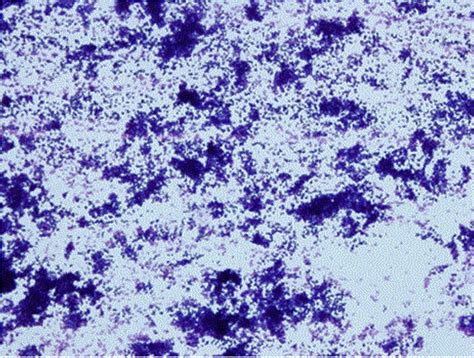 Gram Positive Bacilli From Primary Blood Culture Colonies Of