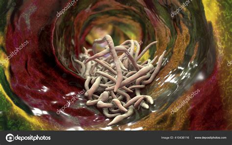 Parasitic Roundworms